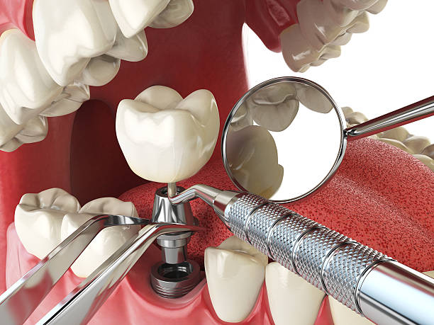 Best Emergency TMJ Treatment in Crimora, VA